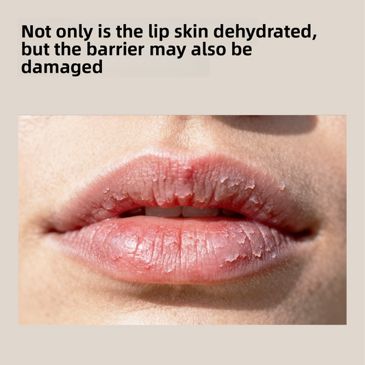 Children's Lip Balm