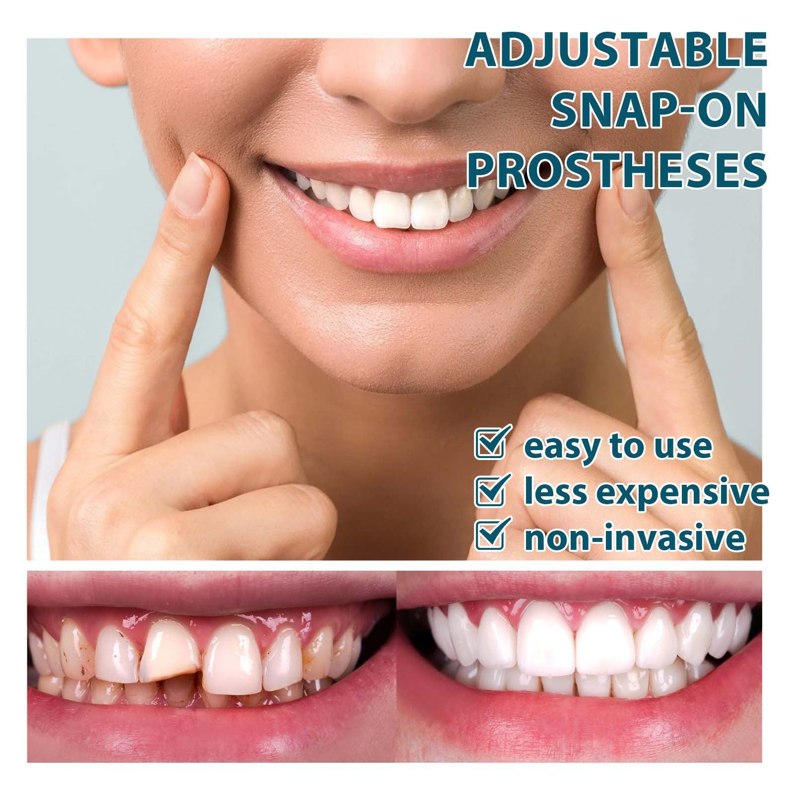 Dental dentures