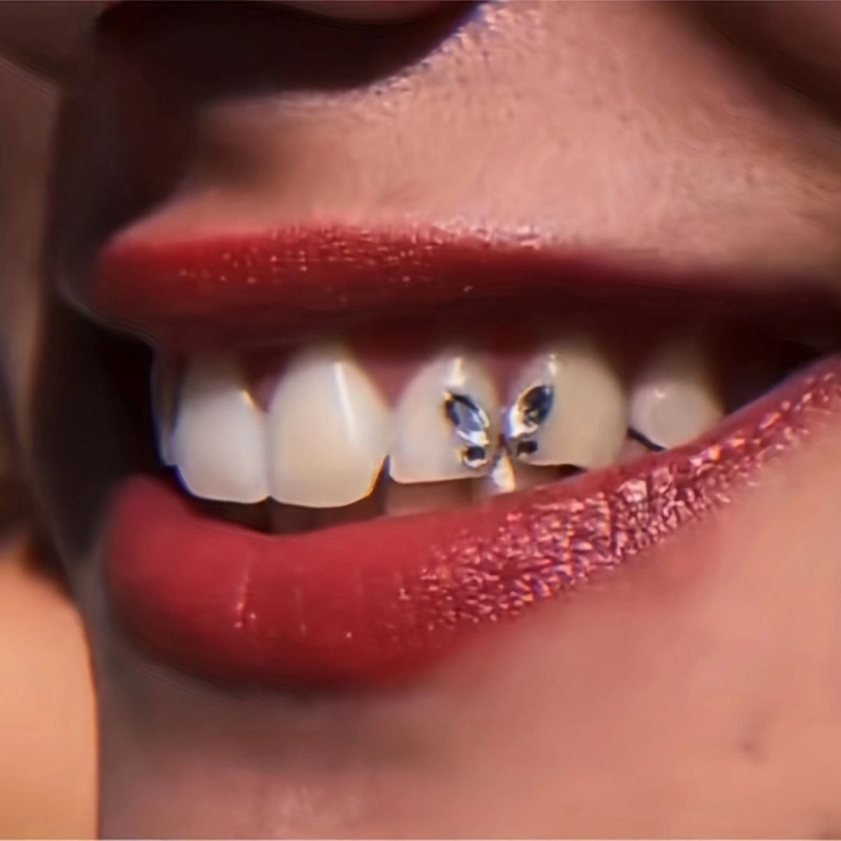 Dental drill