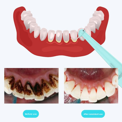 Dental Water Flosser