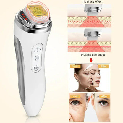Dot Matrix Laser Device