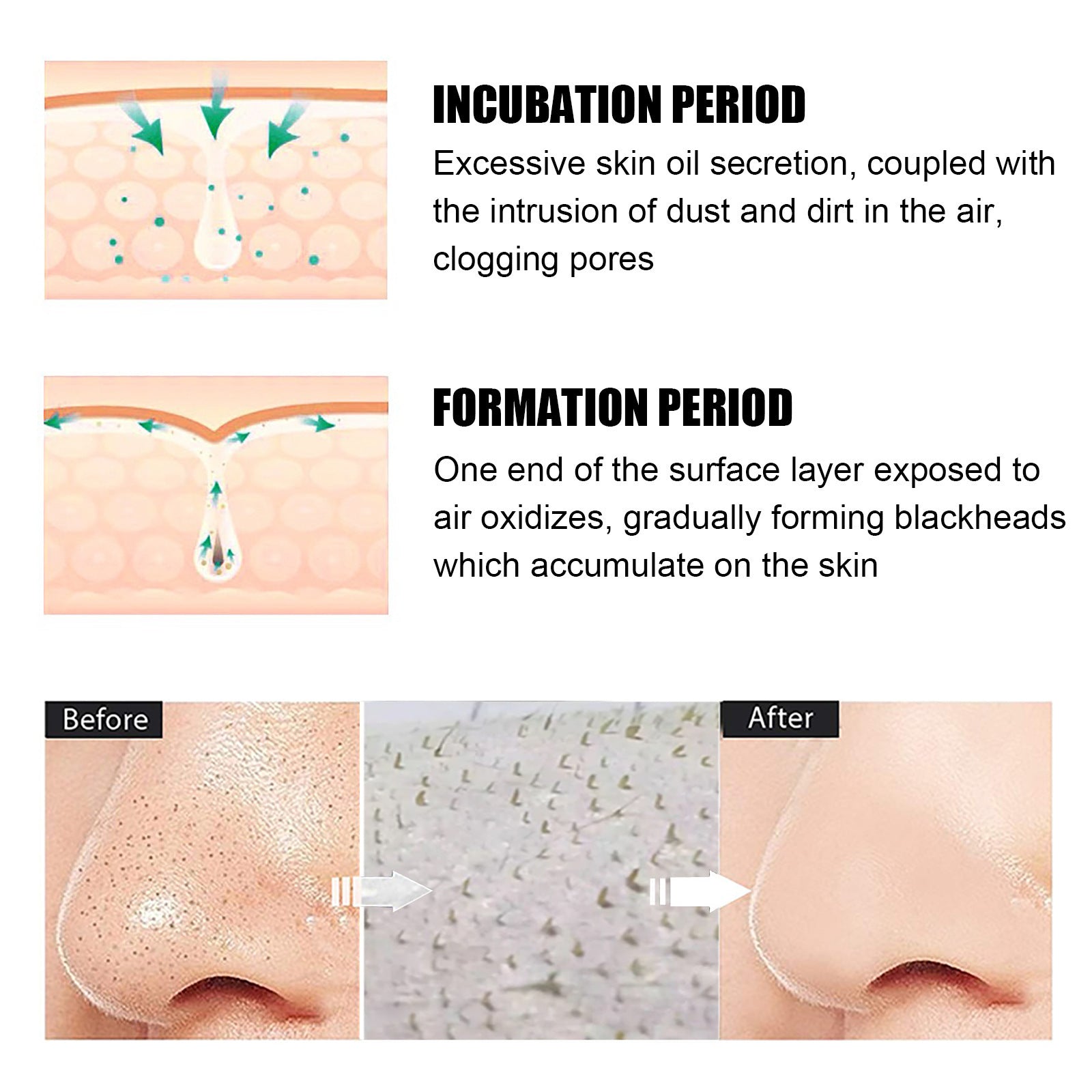 EELHOE Blackhead Remover Peel-Off Nasal Mask