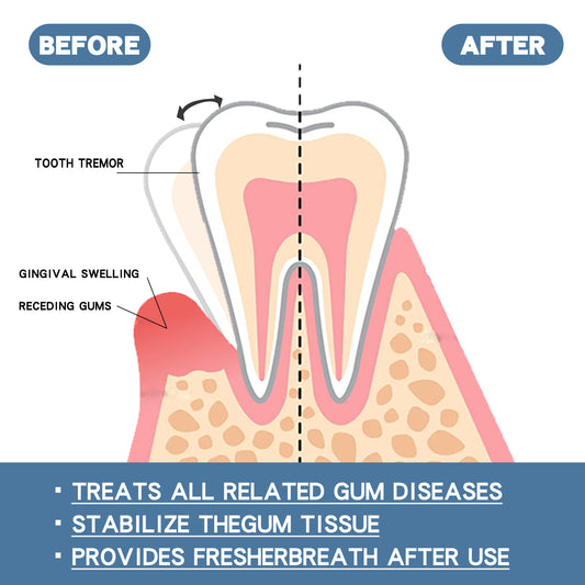 Eelhoe Gum Repair Drops