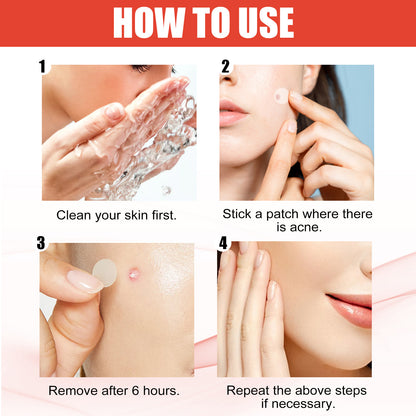 EELHOE Hydrocolloid Acne Patches
