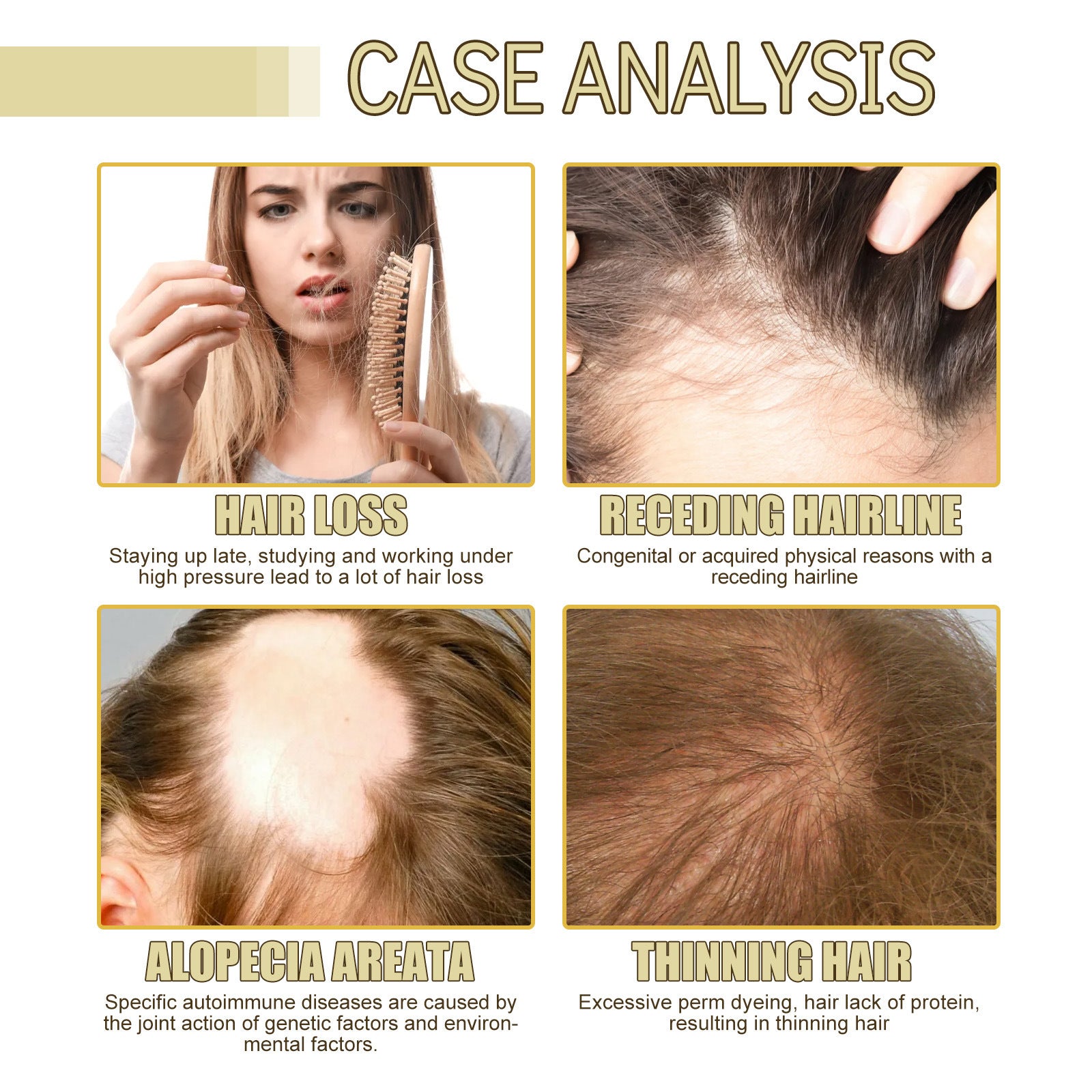 Eelhoe Rosemary Dense Hair Oil Repairs Damaged Hair