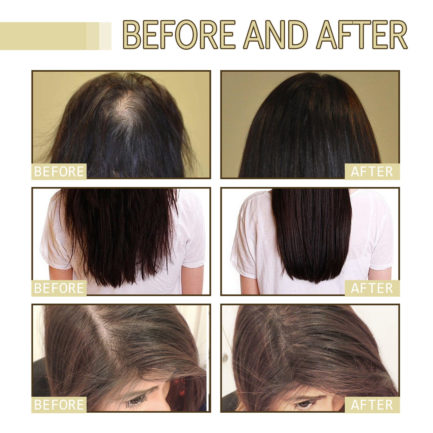 Eelhoe Rosemary Dense Hair Oil Repairs Damaged Hair