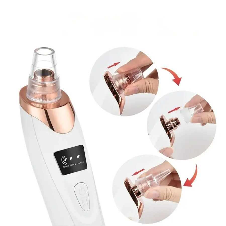 Electric blackhead remover