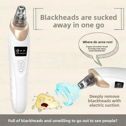 Electric Blackhead Remover