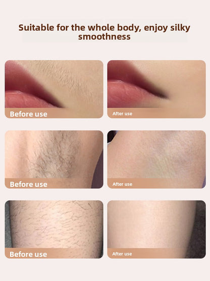 Electric epilator