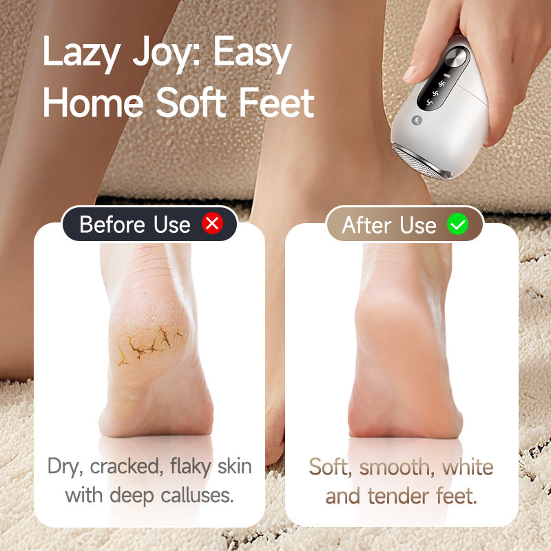 Electric Foot Grinder