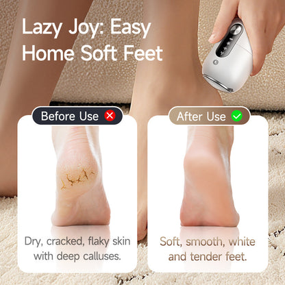 Electric Foot Grinder