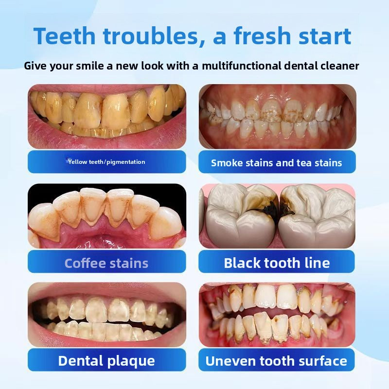 Electric Teeth Cleaning Polisher with Whitening Function