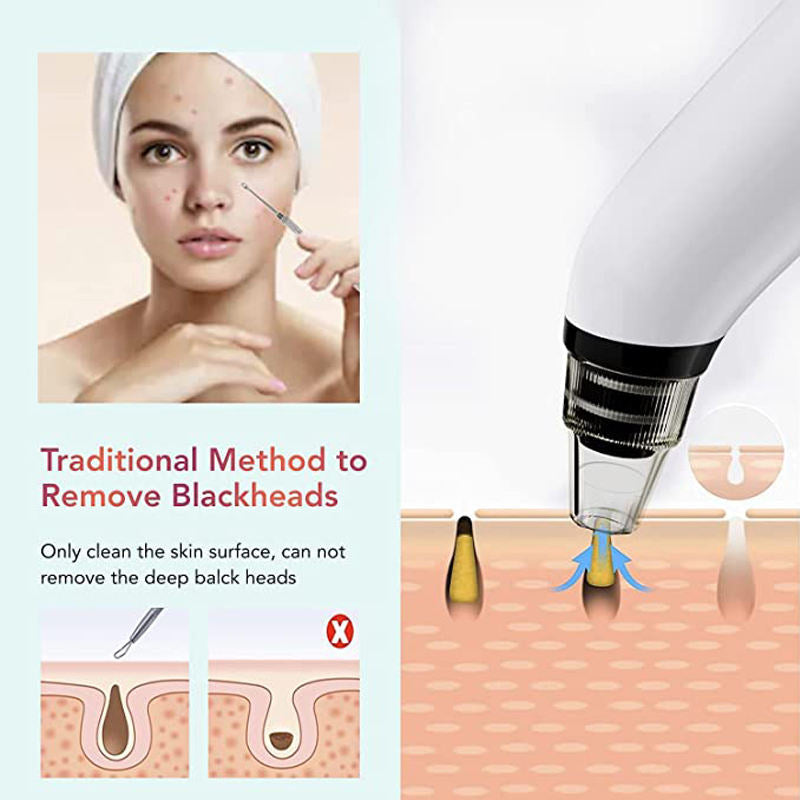 Electronic Facial Pore Cleaner and Blackhead Remover