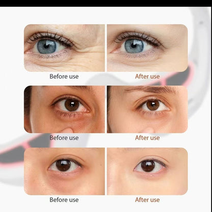 EMS Microcurrent Eye Massager and Essence Device