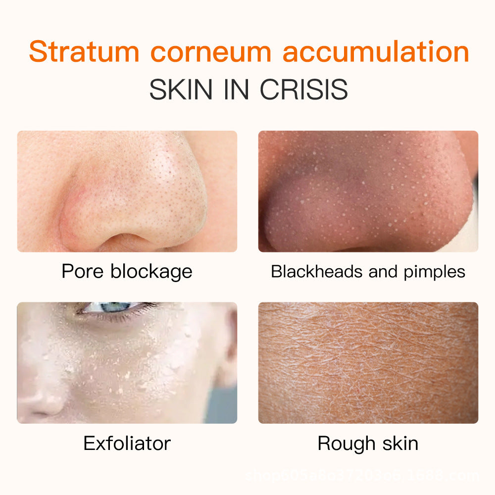 exfoliating gel