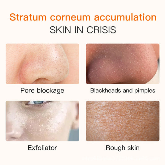 exfoliating gel