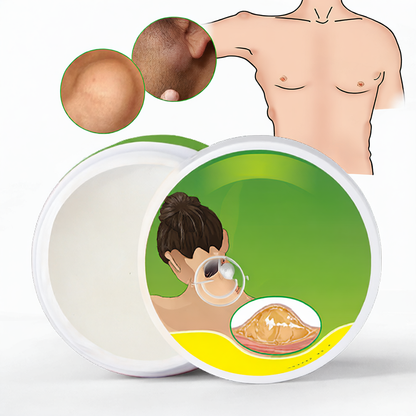 External Use Nursing Cream
