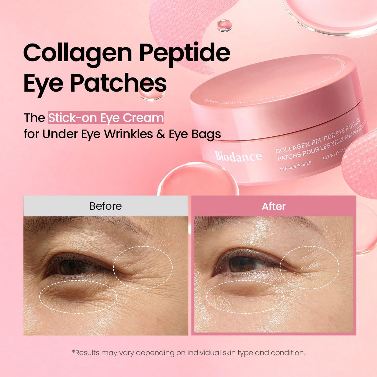 Eye Care Patches