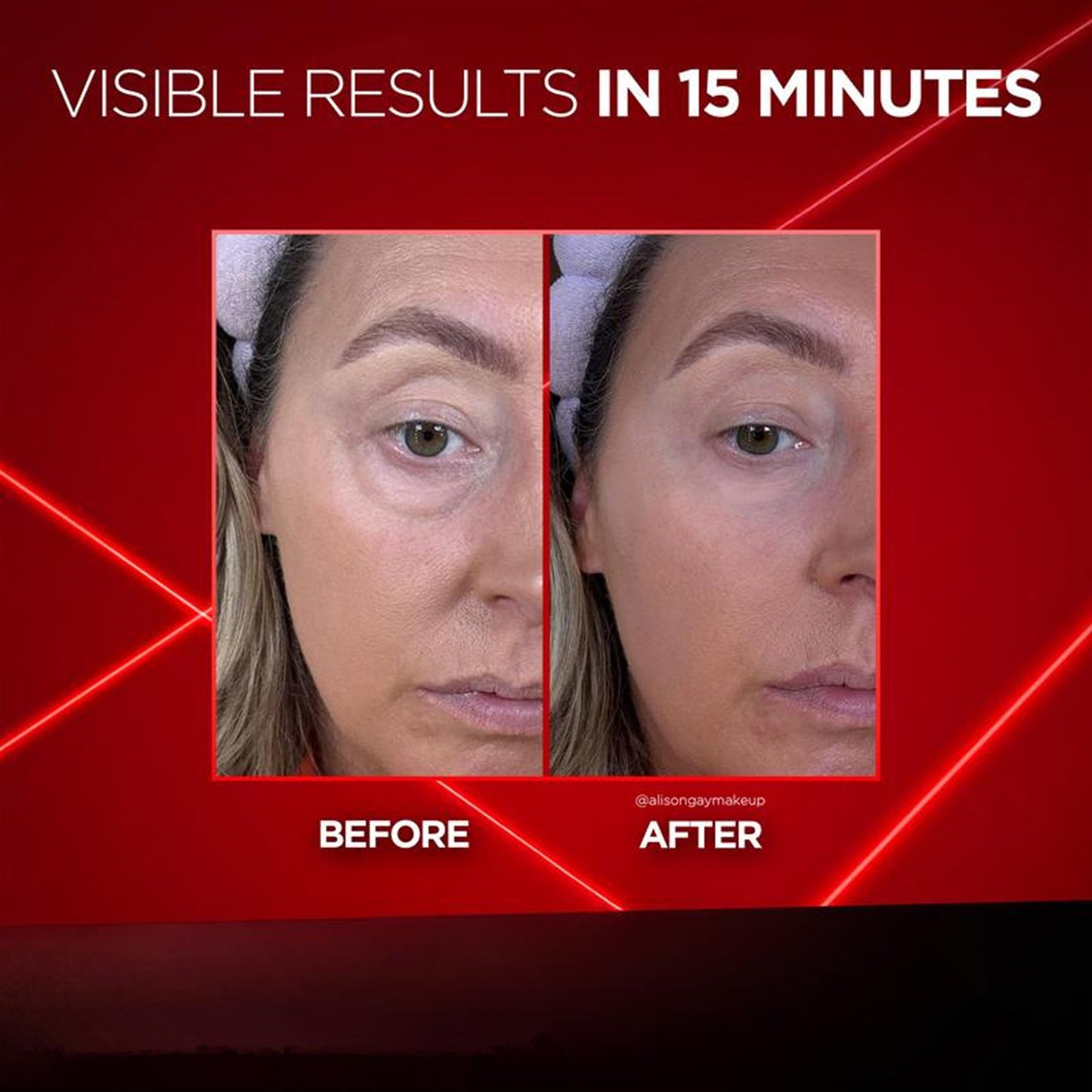eye cream