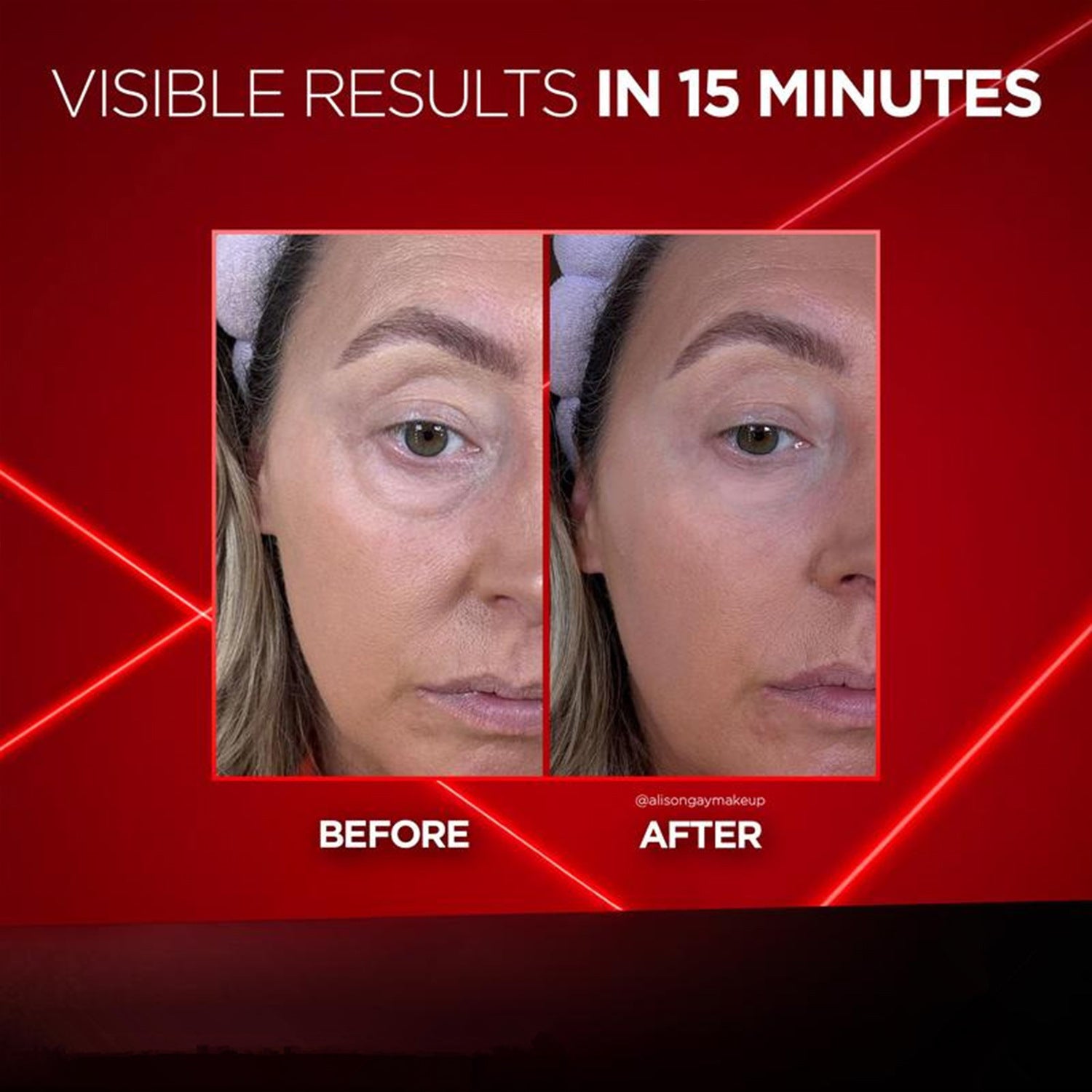 eye cream