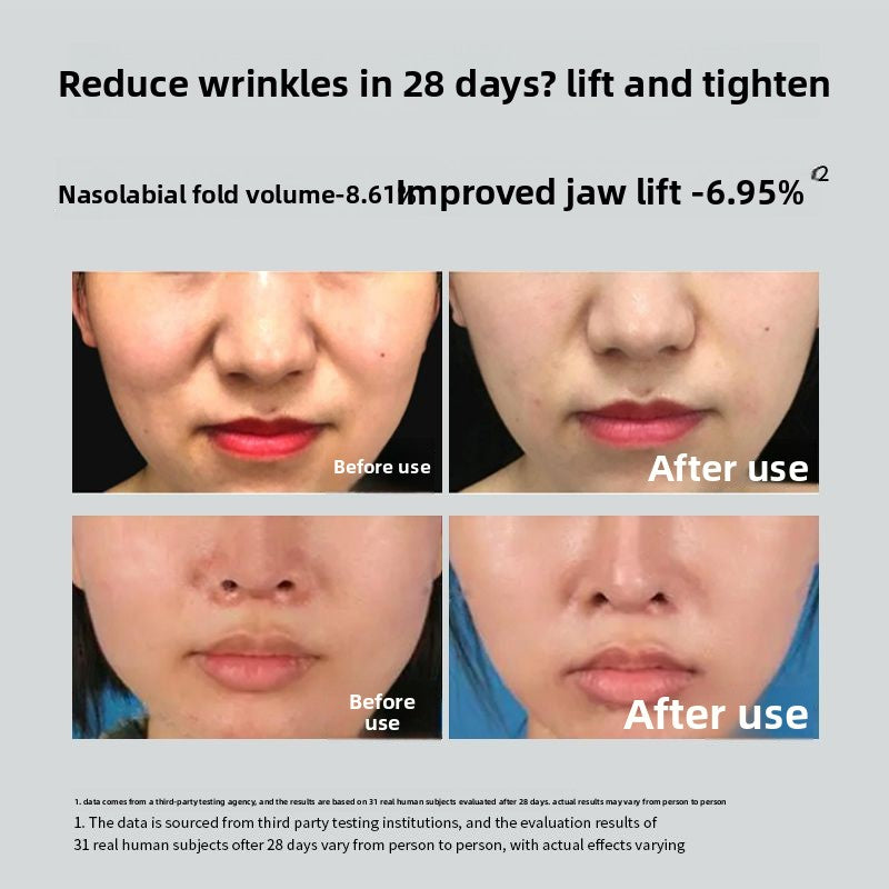 Face Lifting Mask