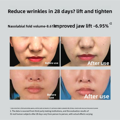 Face Lifting Mask
