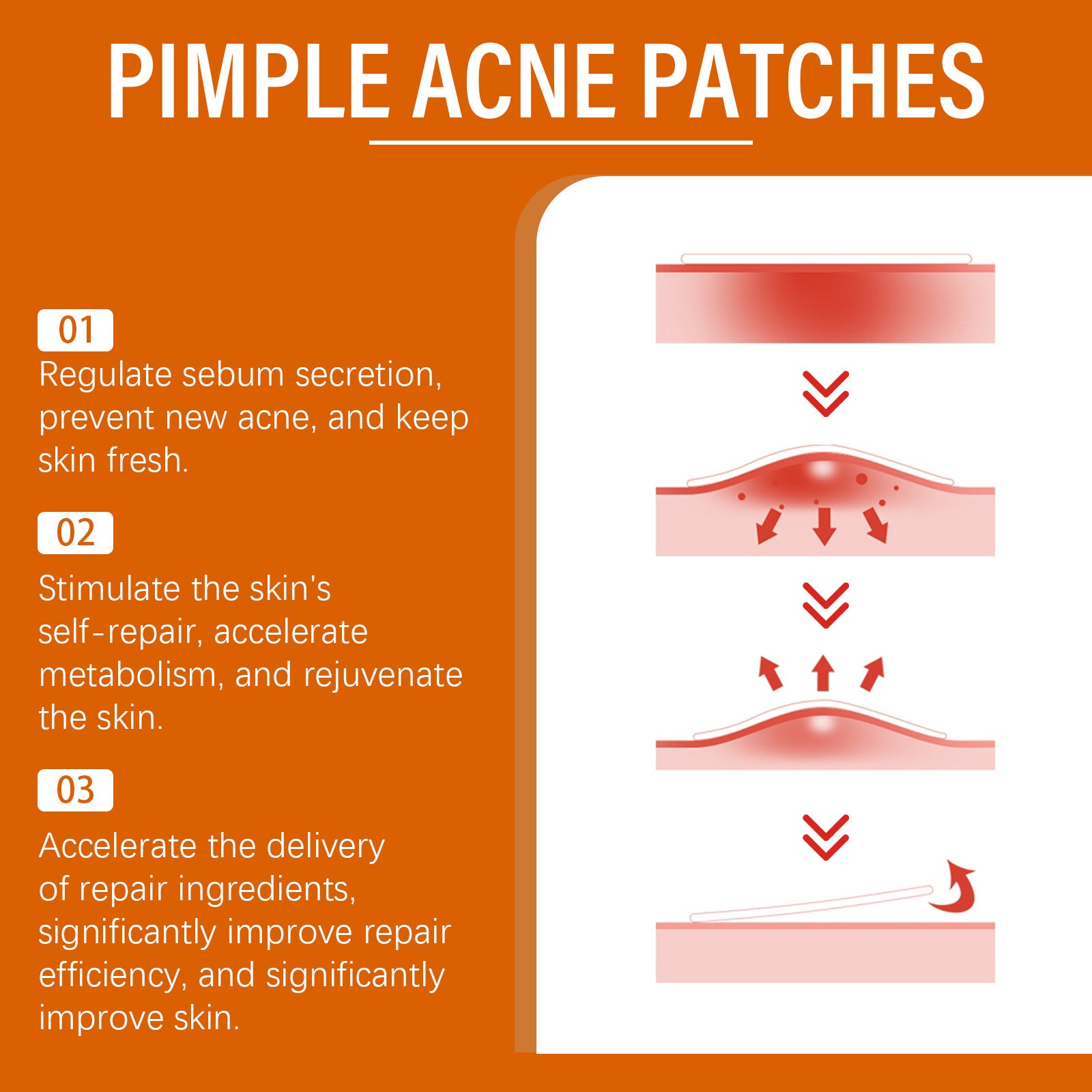 Facial acne patch