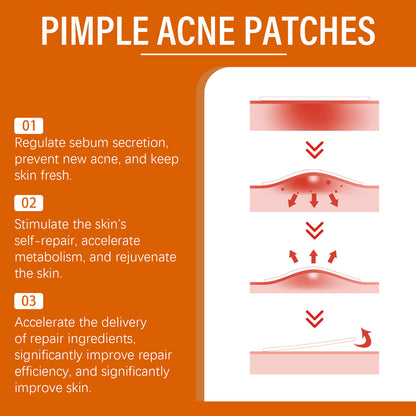 Facial acne patch