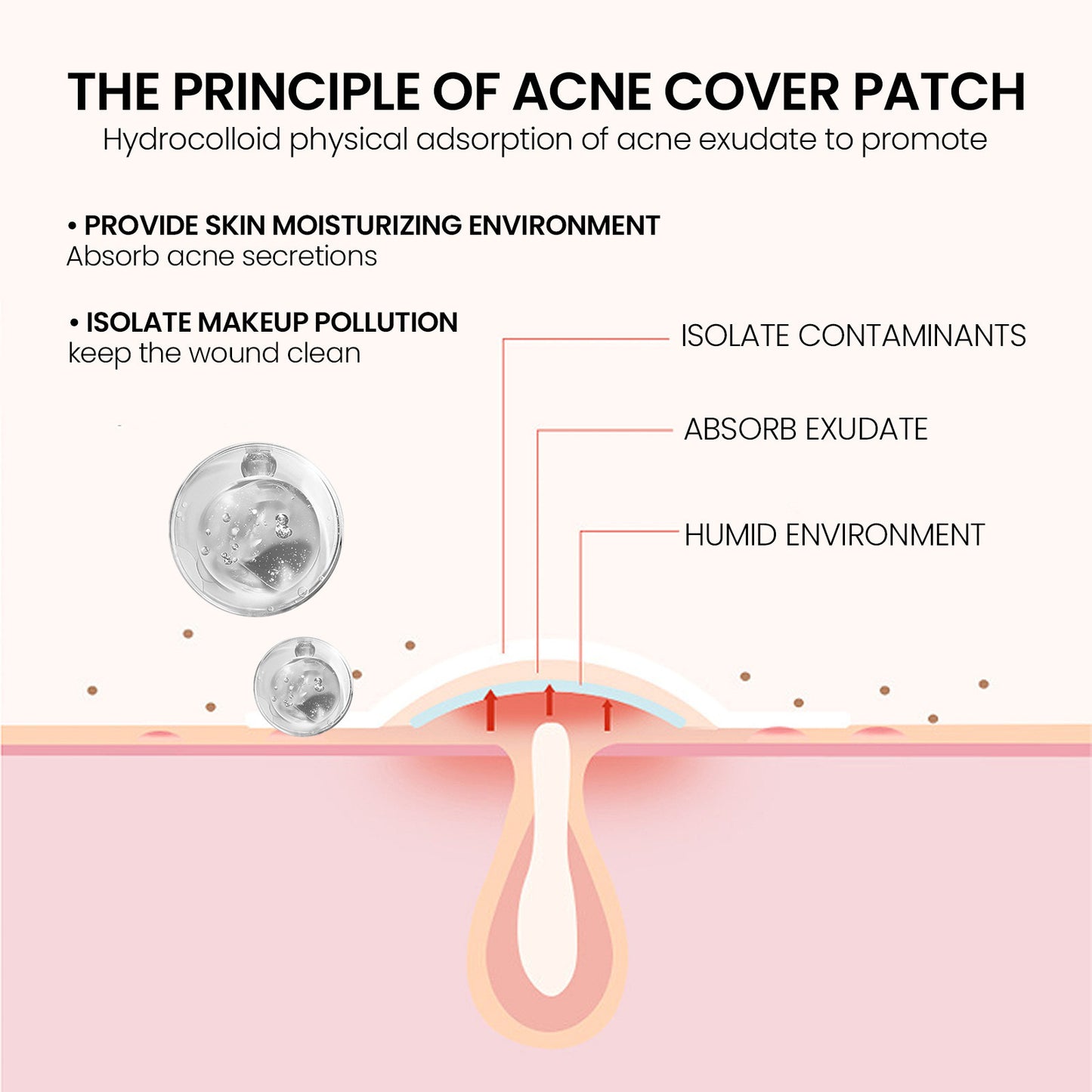 Facial acne patch
