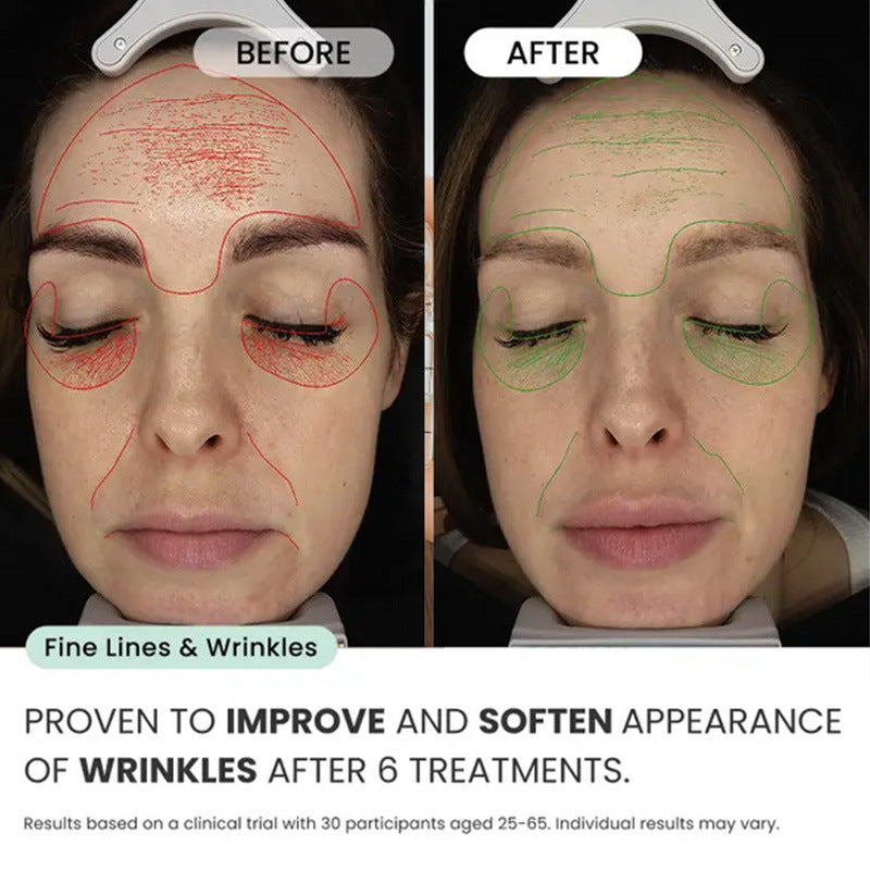 Facial Micro-Needle Essence Set