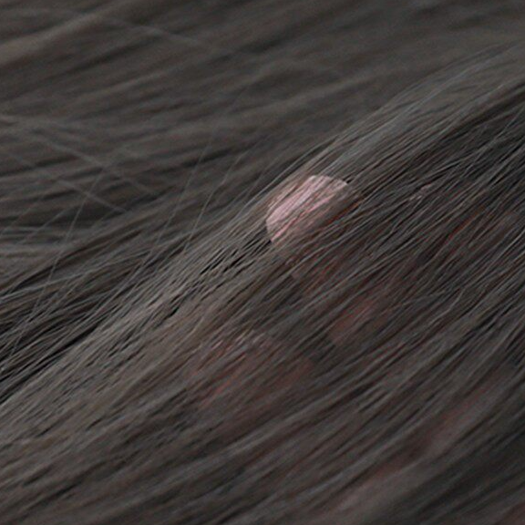 Fibroblast Hair Cap