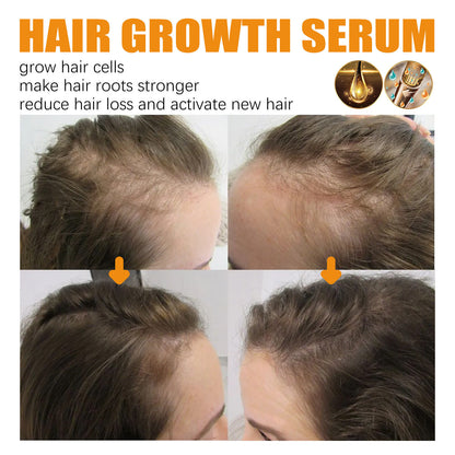 Ginger Hair Fast Growth Serum Spray Biotin Anti Hair Loss
