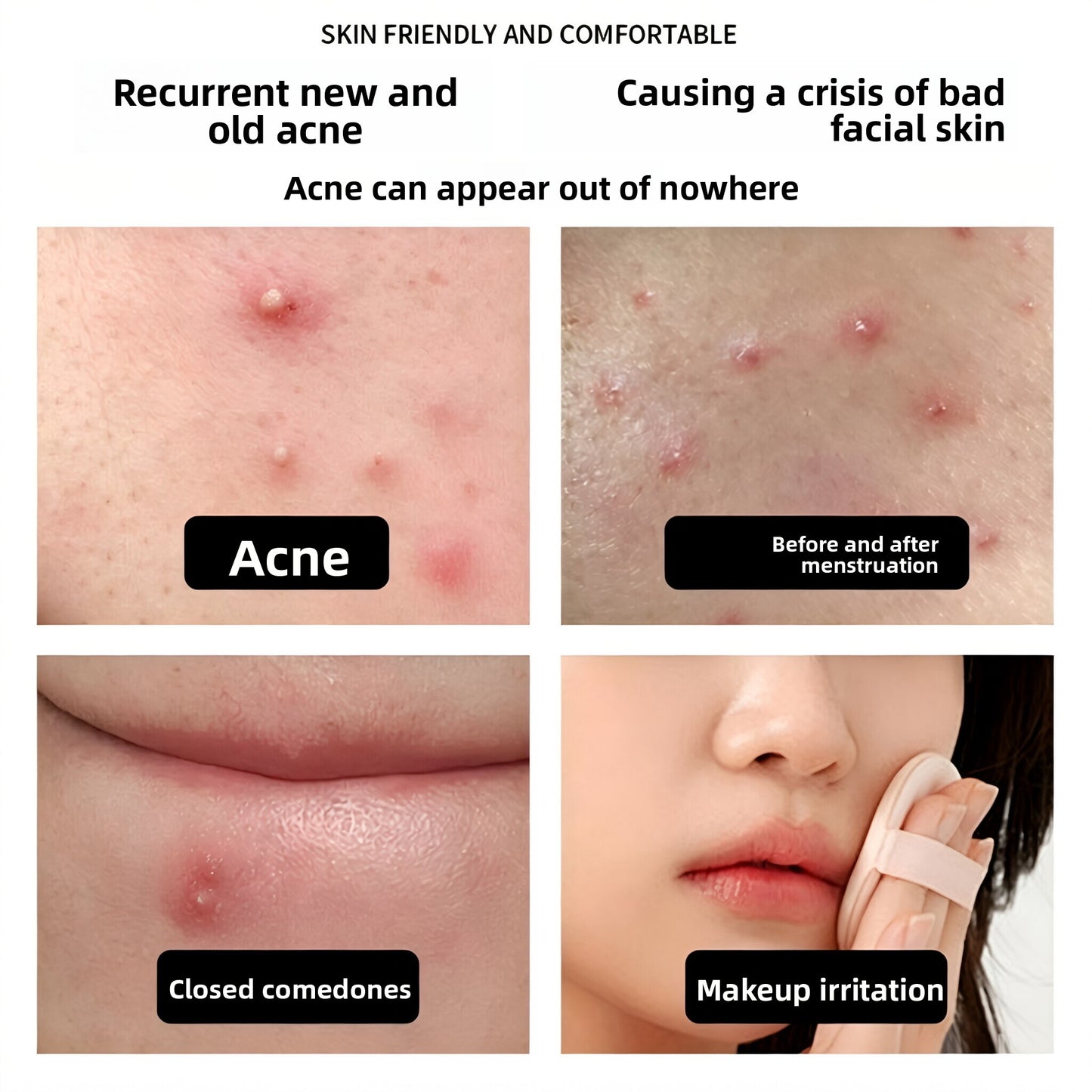 Glitter Hydrocolloid Acne Patches
