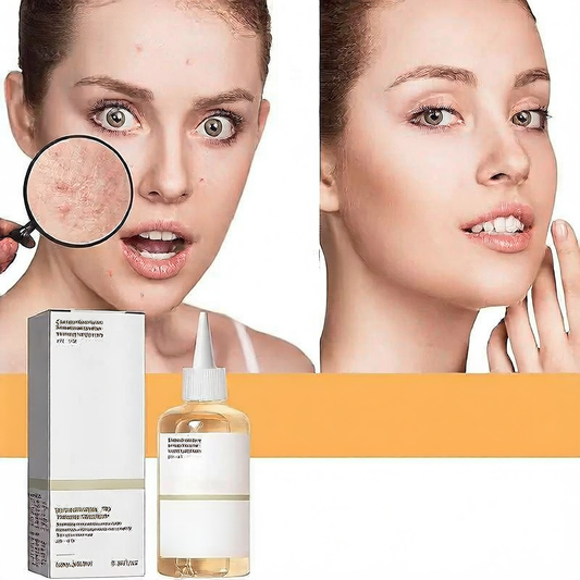 Glycolic Acid Toner