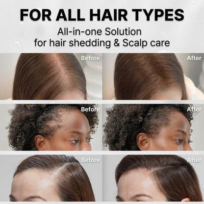 Growturn Hair Growth Serum
