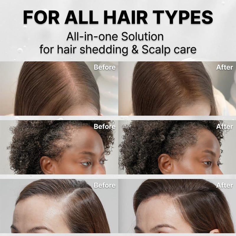 Hair Growth Essence