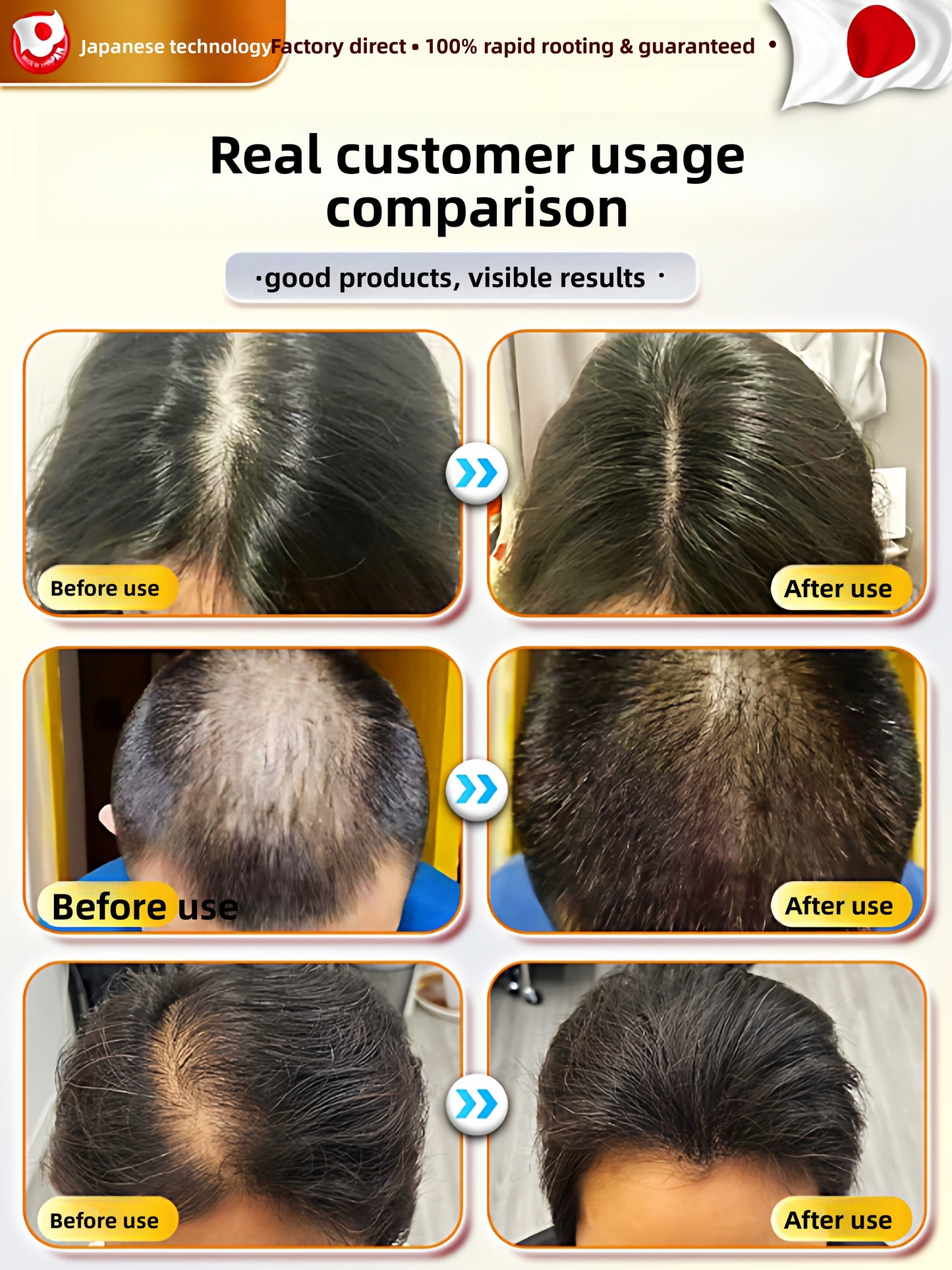 hair growth liquid