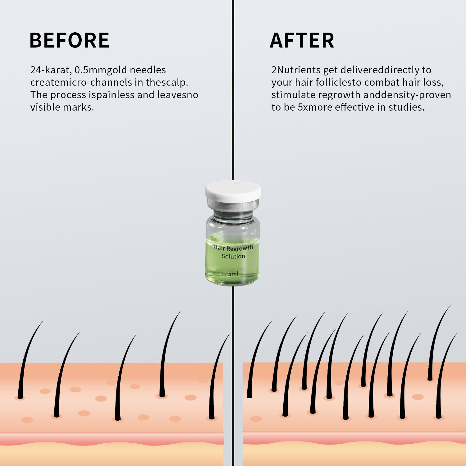 Hair growth microneedle serum