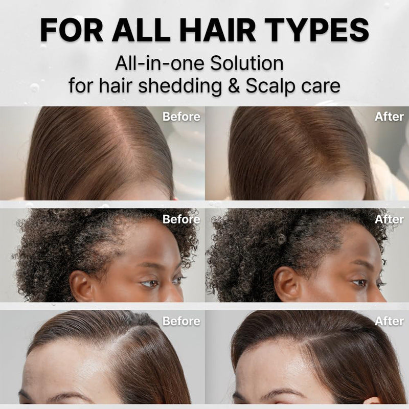Hair Growth Scalp Serum