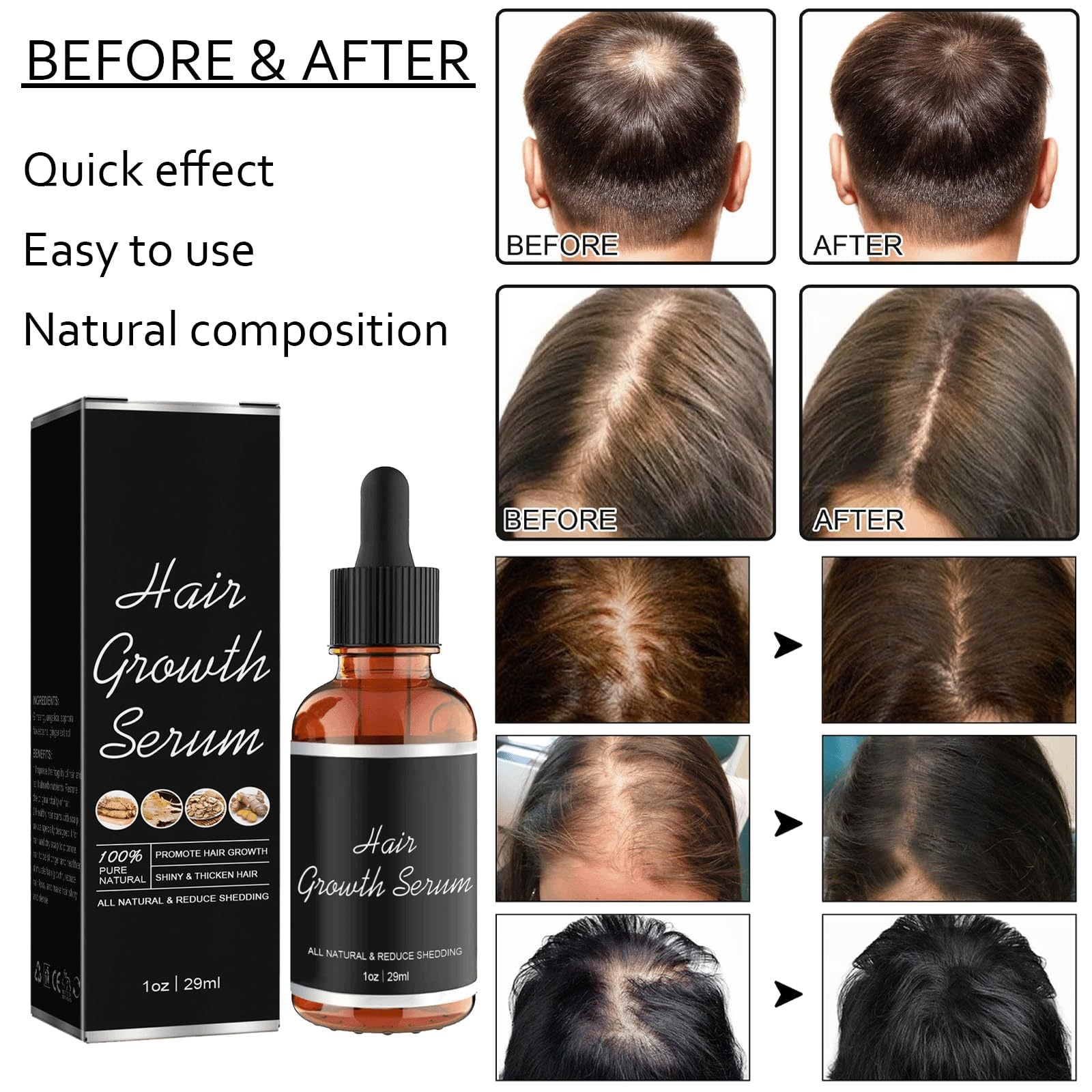 Hair growth serum