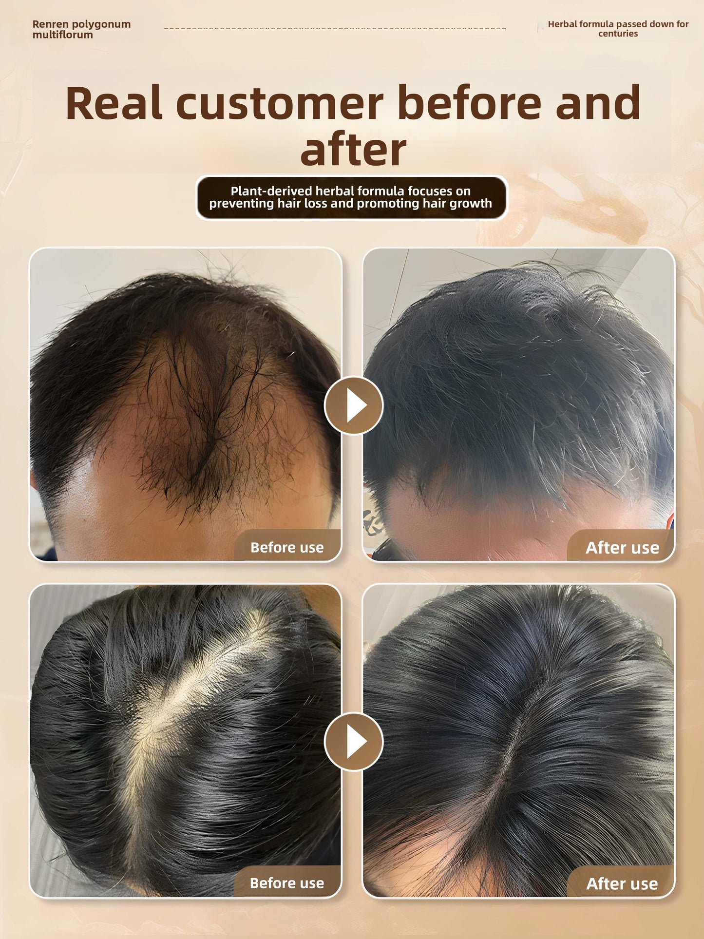 hair growth spray
