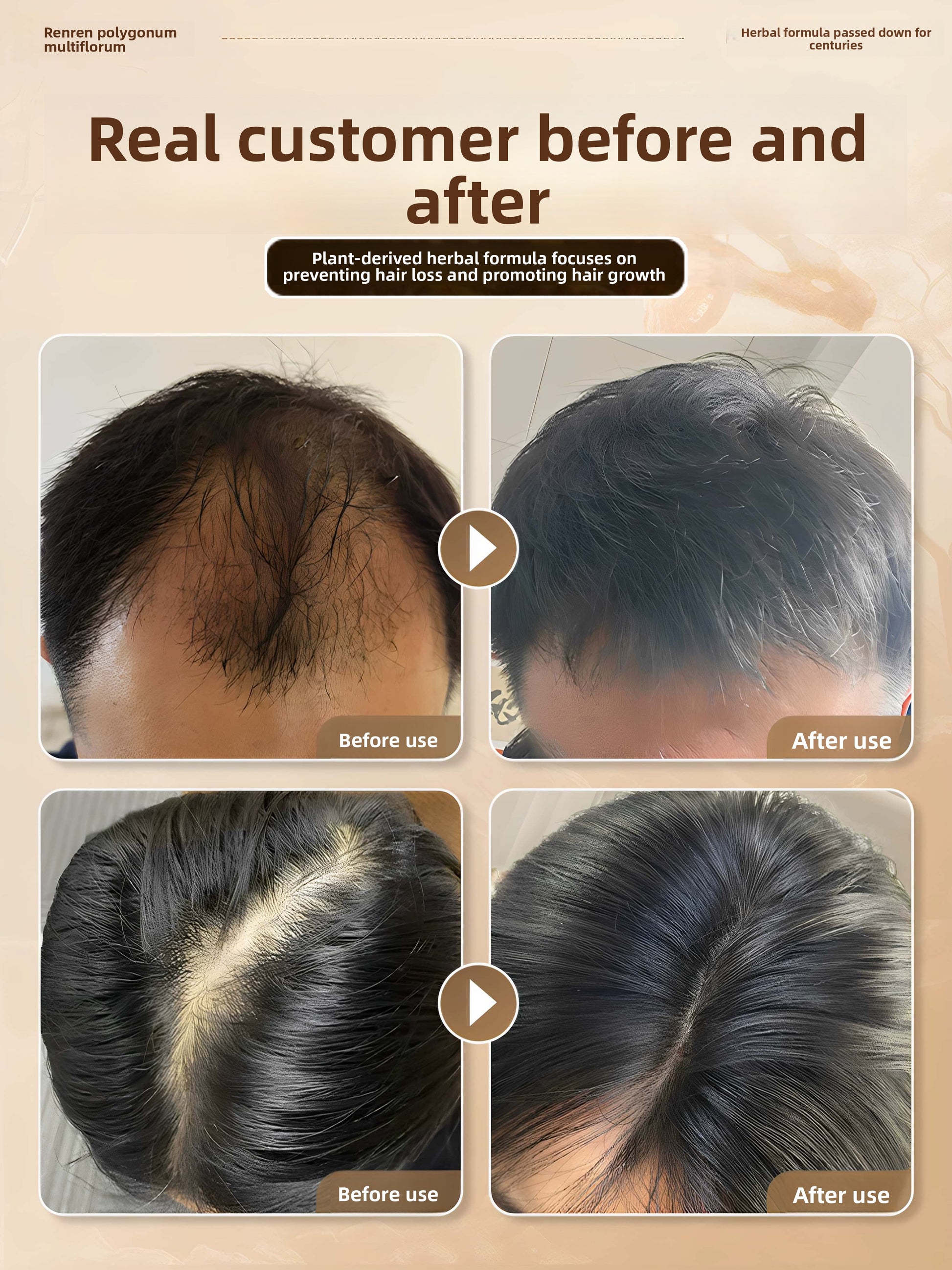 hair growth spray