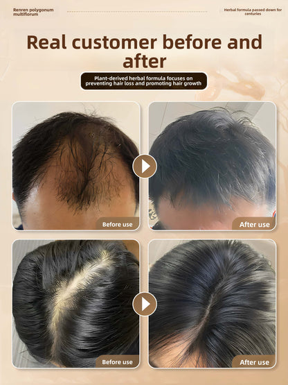 hair growth spray