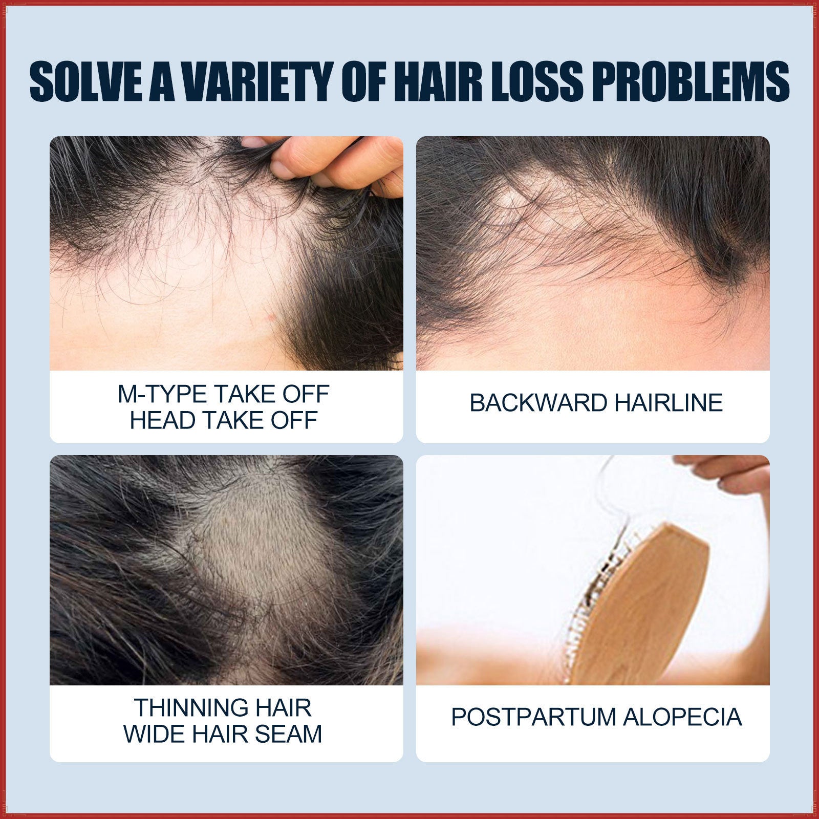 hair growth spray