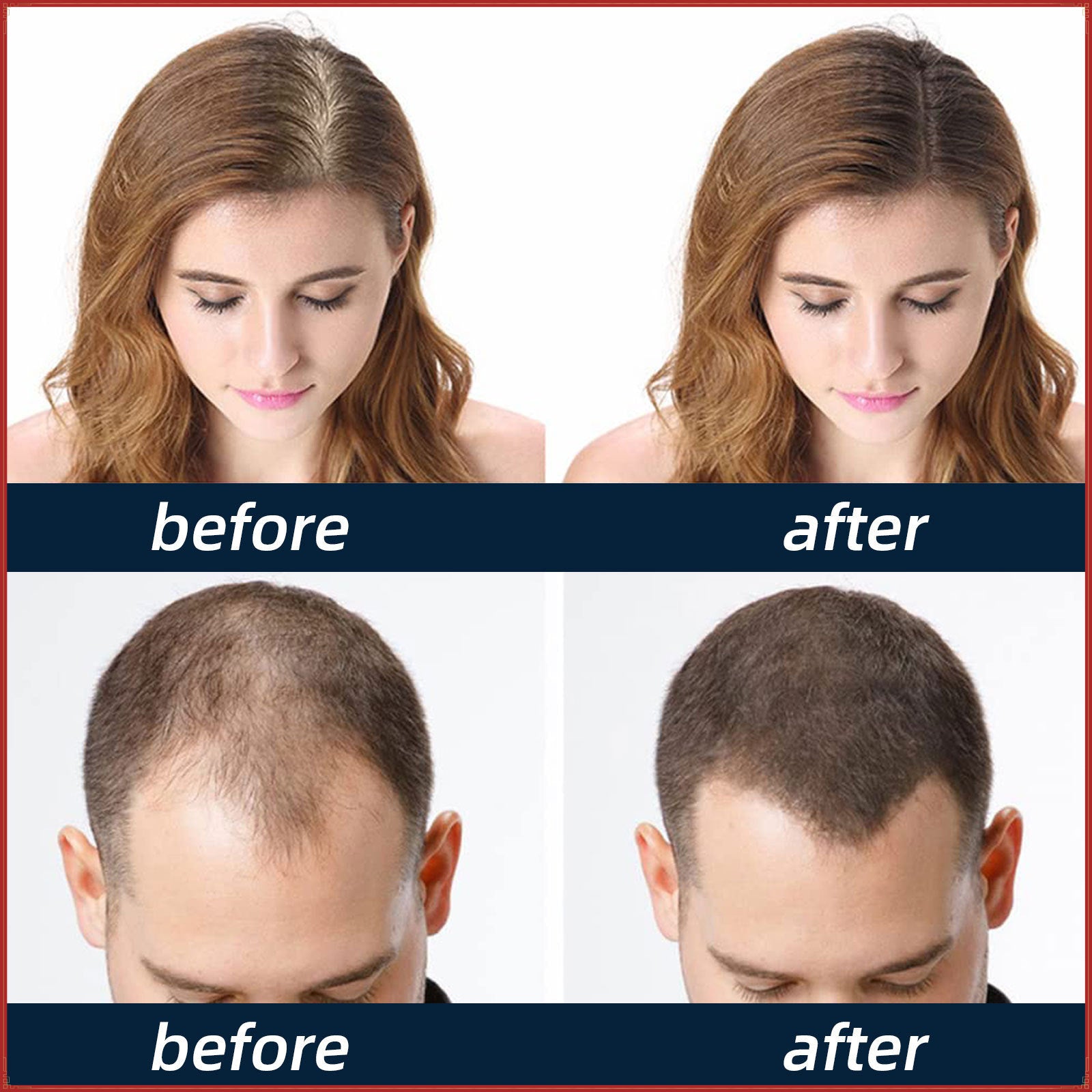 hair growth spray
