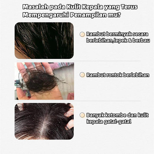 Hair Loss Shampoo