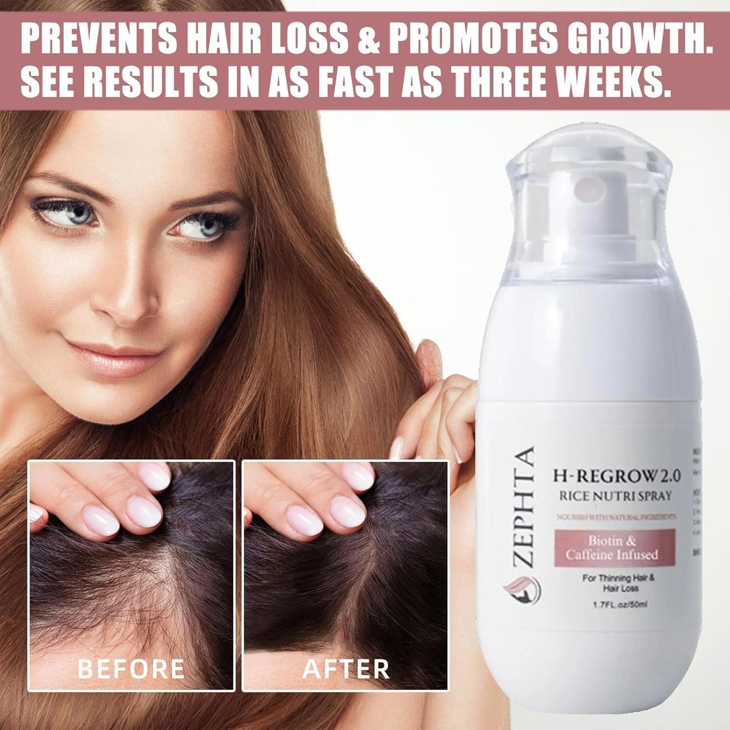 Hair Regrowth Spray