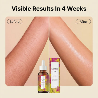 Hair Removal Care Essential Oil