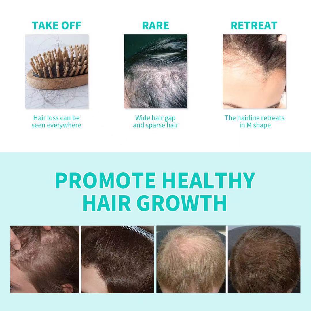 Hair strengthening and care essential oil