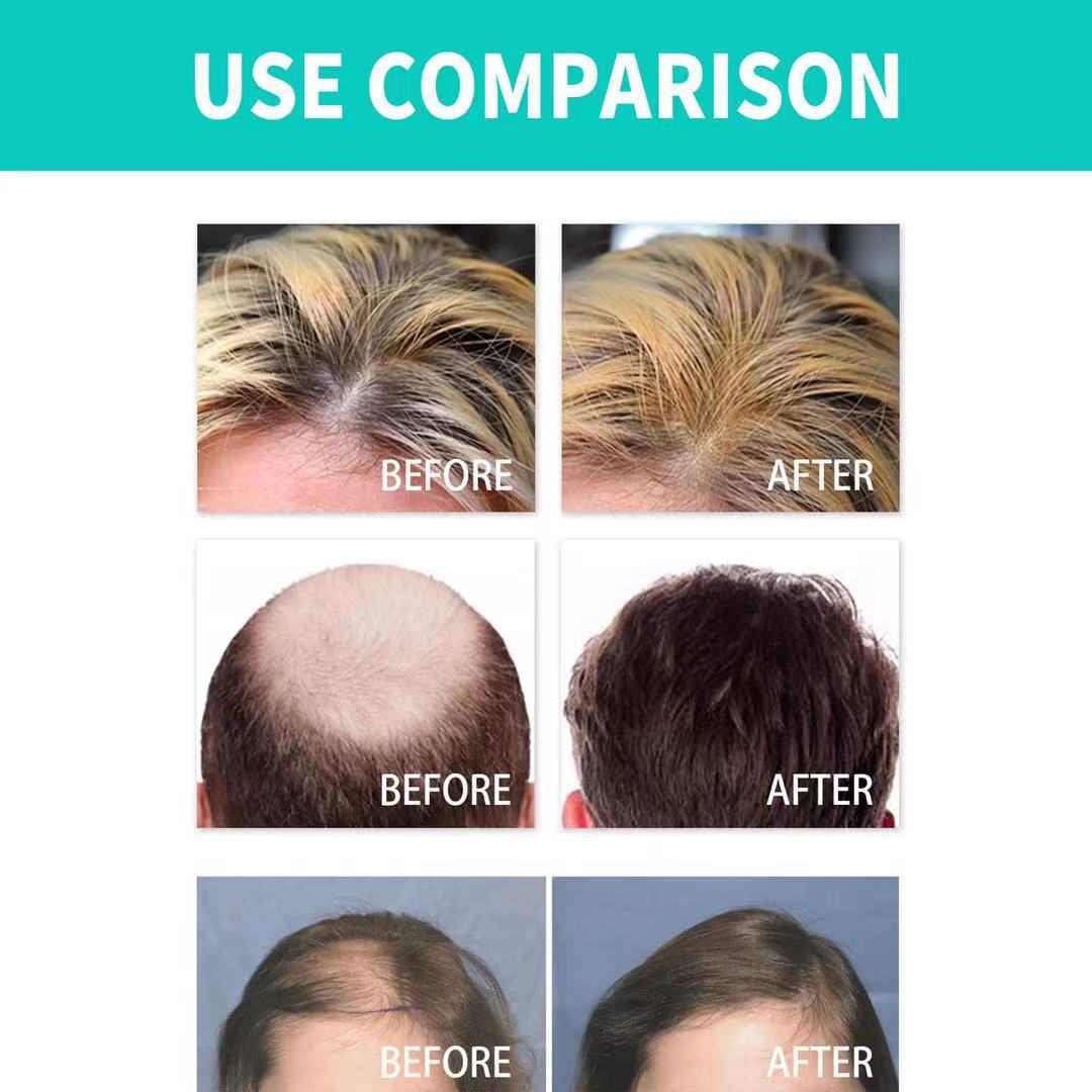 Hair strengthening and care essential oil